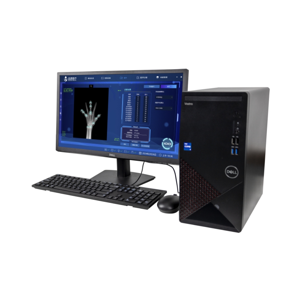 骨龄检测仪BAD-Q4