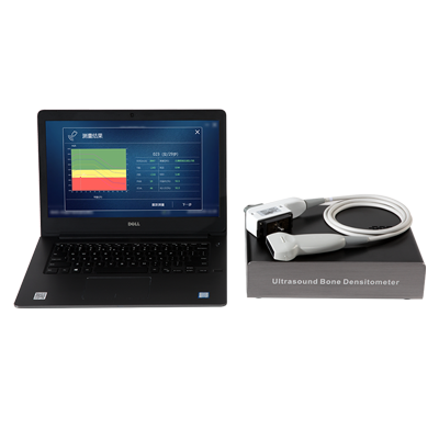 超声骨密度仪BMD-A1套件+笔记本
